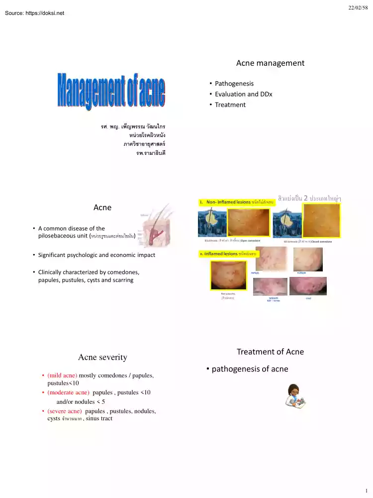 Management of Acne
