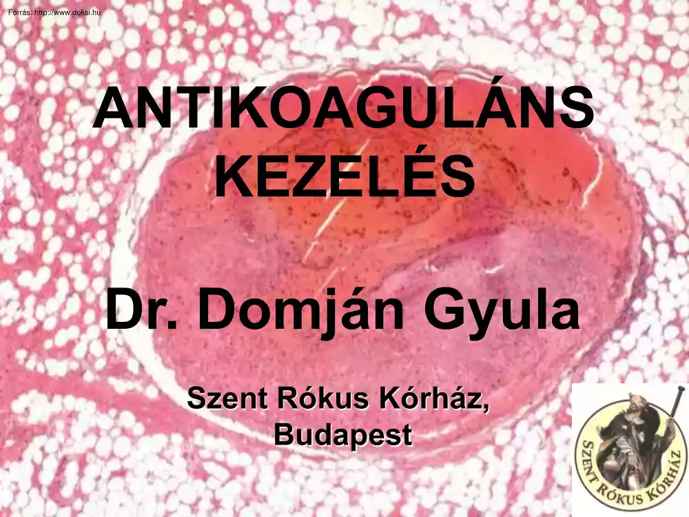 Dr. Domján Gyula - Antikoaguláns kezelés