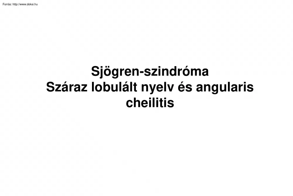Sjögren-szindróma