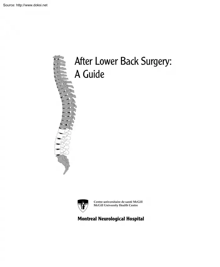 After Lower Back Surgery, A Guide