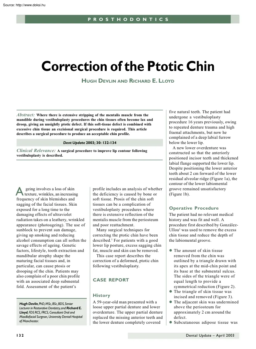 Devlin-Lloyd - Correction of the ptotic chin