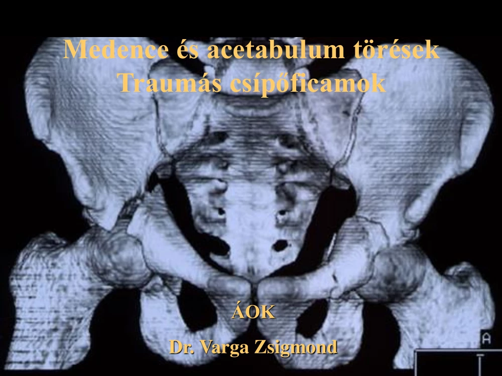 Dr. Varga Zsigmond - Medence és acetabulum törések, traumás csípőficamok