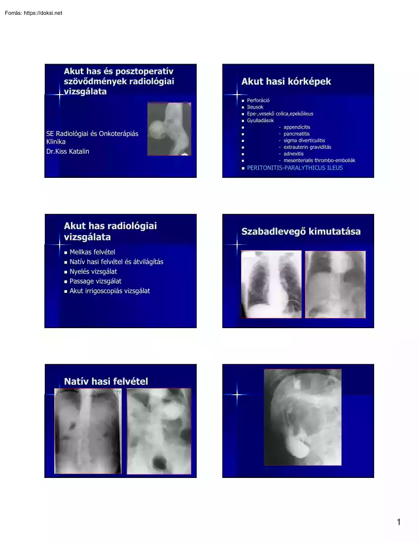 Dr. Kiss Katalin - Akut has és posztoperatív szövődmények radiológiai vizsgálata