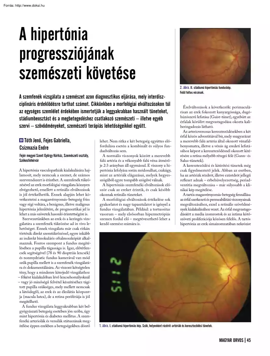 Tóth-Fejes-Csizmazia - A hipertónia progressziójának szemészeti követése