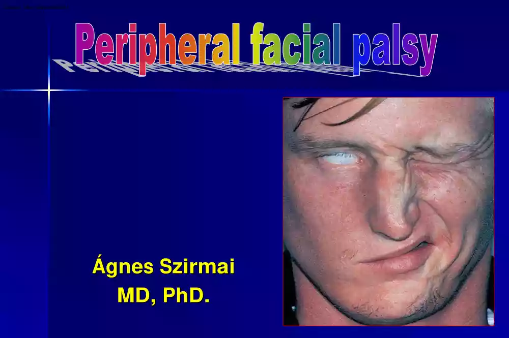 Dr. Ágnes Szirmai - Peripheral facial palsy