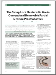 Christopher-Finbarr - The swing-lock denture, its use in conventional removable partial denture prosthodontics