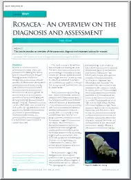 Paula Oliver - Rosacea, An Overview on the Diagnosis and Assessment