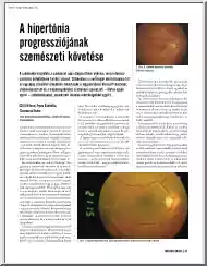 Tóth-Fejes-Csizmazia - A hipertónia progressziójának szemészeti követése