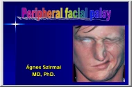 Dr. Ágnes Szirmai - Peripheral facial palsy